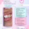 Curso de Gemas Dentales + Kit Profesional Starter | Formación Online con Material Incluido y Certificado