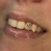 GlowLens Studio – Luz LED con Lente Macro para Fotos de Gemas Dentales
